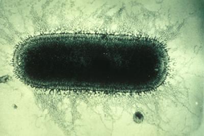 Electron microscope image of rabies virus